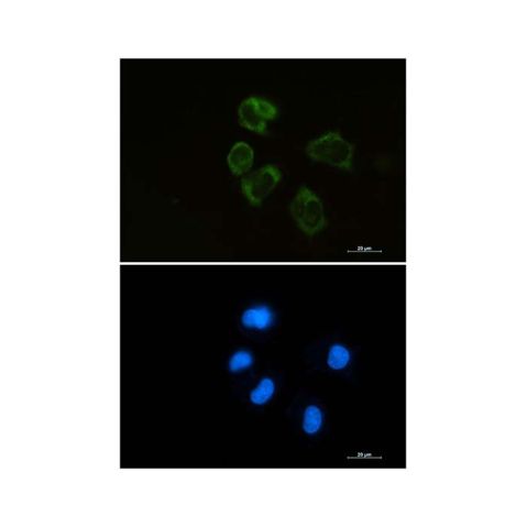 aladdin 阿拉丁 Ab113835 Recombinant Lysozyme Antibody Recombinant (R09-9D6); Rabbit anti Human Lysozyme Antibody; WB, ICC, IF; Unconjugated