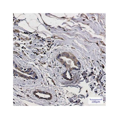 aladdin 阿拉丁 Ab114168 Recombinant MAP1LC3A Antibody Recombinant (R07-9B1); Rabbit anti Human MAP1LC3A Antibody; WB, IHC; Unconjugated