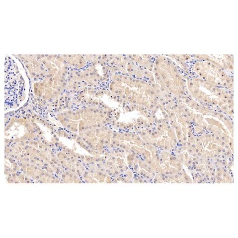 aladdin 阿拉丁 Ab114244 MAPRE1/EB1 Mouse mAb mAb (C4); Mouse anti Human MAPRE1/EB1 Antibody; WB, IHC; Unconjugated