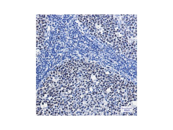 aladdin 阿拉丁 Ab114573 Recombinant MCM7/PRL Antibody Recombinant (R02-7D2); Rabbit anti Human MCM7/PRL Antibody; WB, IHC; Unconjugated
