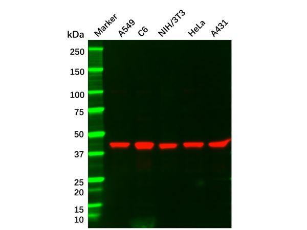aladdin 阿拉丁 Ab114854 Recombinant MEK1 Antibody Recombinant (R07-8C5); Rabbit anti Human MEK1 Antibody; WB; Unconjugated