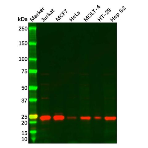 aladdin 阿拉丁 Ab115239 MGMT Antibody pAb; Rabbit anti Human MGMT Antibody; WB, IHC; Unconjugated