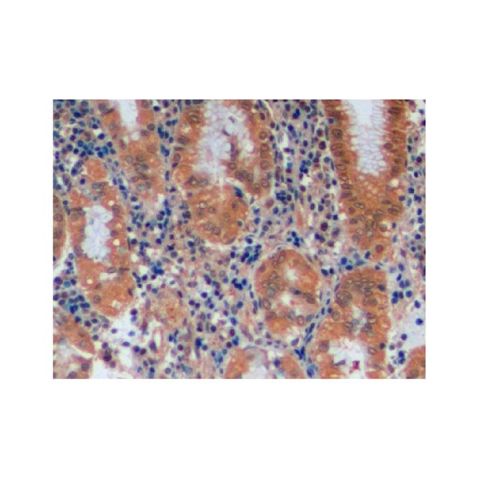 aladdin 阿拉丁 Ab115239 MGMT Antibody pAb; Rabbit anti Human MGMT Antibody; WB, IHC; Unconjugated