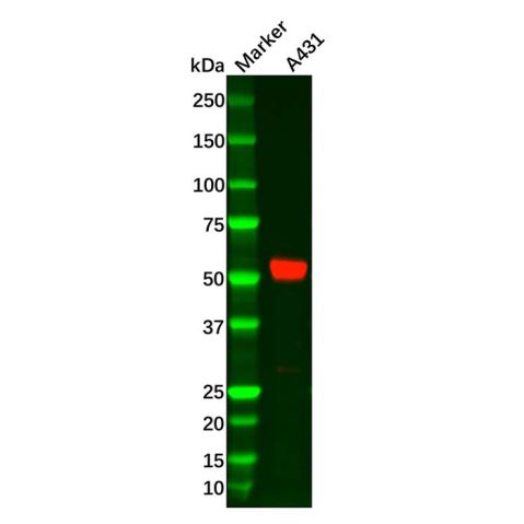 aladdin 阿拉丁 Ab115644 Recombinant MMP14 Antibody Recombinant (R05-6H5); Rabbit anti Human MMP14 Antibody; WB, IHC; Unconjugated