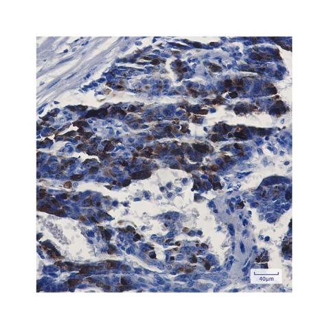 aladdin 阿拉丁 Ab115644 Recombinant MMP14 Antibody Recombinant (R05-6H5); Rabbit anti Human MMP14 Antibody; WB, IHC; Unconjugated