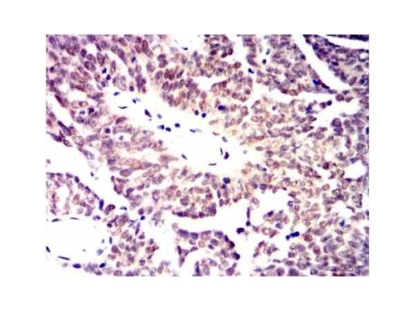 aladdin 阿拉丁 Ab115912 Mre11 Mouse mAb mAb(7C8A9); Mouse anti Human Mre11 Antibody; ELISA, WB, Flow, IHC; Unconjugated