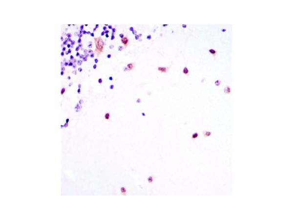 aladdin 阿拉丁 Ab116122 MSI2 Mouse mAb mAb(2C11); Mouse anti Human MSI2 Antibody; WB, IHC, ELISA; Unconjugated