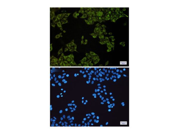 aladdin 阿拉丁 Ab116168 Recombinant MST4 Antibody Recombinant (R08-2H9); Rabbit anti Human MST4 Antibody; WB, IF, ICC; Unconjugated