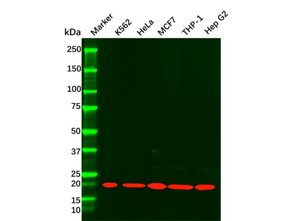 aladdin 阿拉丁 Ab116239 Recombinant MTCO2 Antibody Recombinant (R05-2E2); Rabbit anti Human MTCO2 Antibody; WB, IHC, IF, ICC; Unconjugated