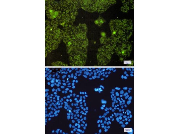 aladdin 阿拉丁 Ab116239 Recombinant MTCO2 Antibody Recombinant (R05-2E2); Rabbit anti Human MTCO2 Antibody; WB, IHC, IF, ICC; Unconjugated