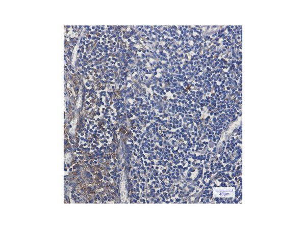 aladdin 阿拉丁 Ab116239 Recombinant MTCO2 Antibody Recombinant (R05-2E2); Rabbit anti Human MTCO2 Antibody; WB, IHC, IF, ICC; Unconjugated