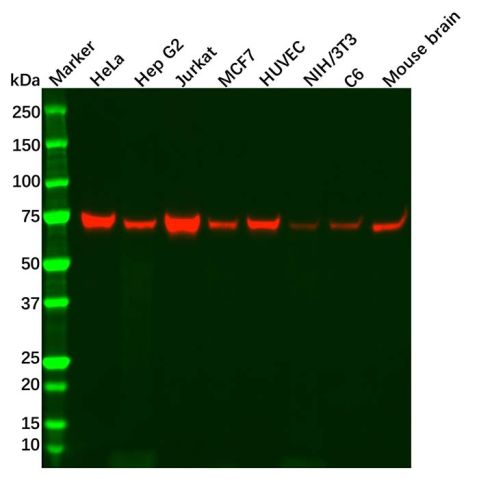 aladdin 阿拉丁 Ab117821 Recombinant NF2/Merlin Antibody Recombinant (R07-1A6); Rabbit anti Human NF2/Merlin Antibody; WB; Unconjugated