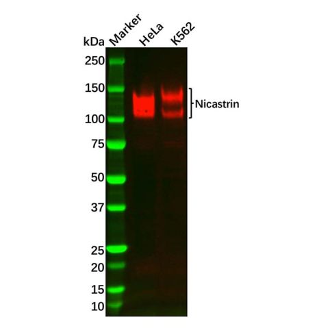 aladdin 阿拉丁 Ab118034 Recombinant Nicastrin Antibody Recombinant (R02-9E6); Rabbit anti Human Nicastrin Antibody; WB; Unconjugated