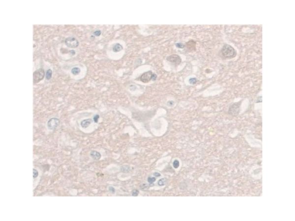 aladdin 阿拉丁 Ab118776 CD8 alpha Mouse mAb mAb (C14); Mouse anti Human CD8 alpha Antibody; WB, IHC; Unconjugated