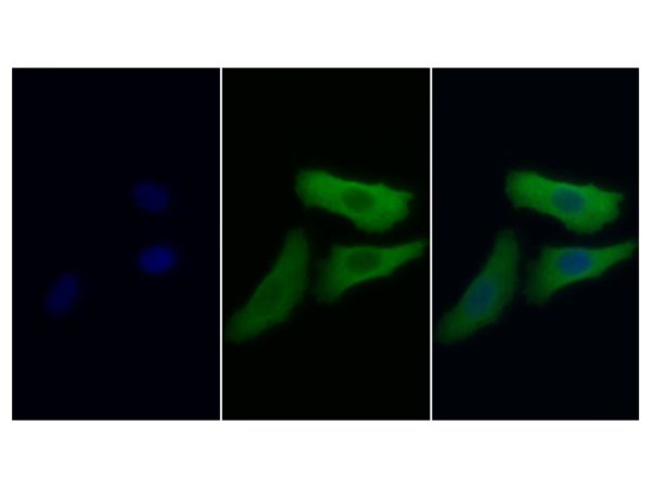 aladdin 阿拉丁 Ab118776 CD8 alpha Mouse mAb mAb (C14); Mouse anti Human CD8 alpha Antibody; WB, IHC; Unconjugated