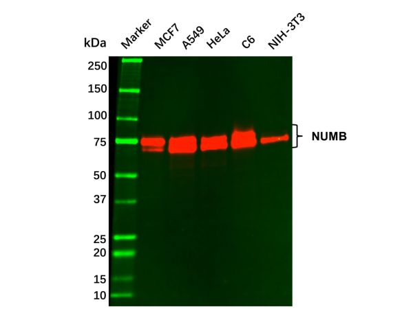 aladdin 阿拉丁 Ab119000 Recombinant NUMB Antibody Recombinant (R09-2I5); Rabbit anti Human NUMB Antibody; WB, IHC; Unconjugated