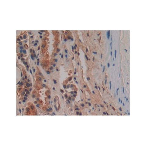 aladdin 阿拉丁 Ab119430 Osteopontin Antibody pAb; Rabbit anti Human Osteopontin Antibody; WB, IHC; Unconjugated