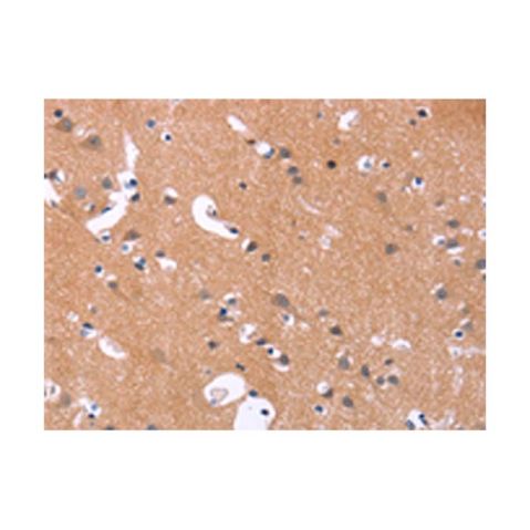 aladdin 阿拉丁 Ab119724 MAPK11 Antibody pAb; Rabbit anti Human MAPK11 Antibody; WB, IHC; Unconjugated