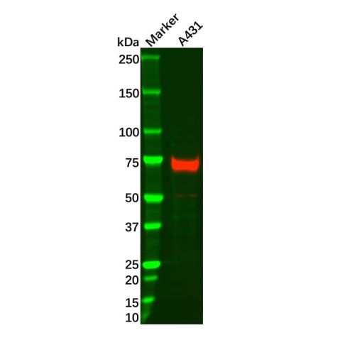 aladdin 阿拉丁 Ab119899 p63 Mouse mAb mAb (D2); Mouse anti Human p63 Antibody; WB; Unconjugated
