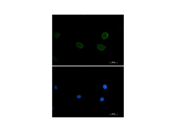 aladdin 阿拉丁 Ab119916 Recombinant P70 S6 Kinase beta/SRK Antibody Recombinant (R04-9C1); Rabbit anti Human P70 S6 Kinase beta/SRK Antibody; WB, IHC, ICC, IF; Unconjugated