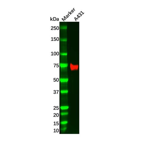 aladdin 阿拉丁 Ab119935 Recombinant NGFR Antibody Recombinant (R05-7D3); Rabbit anti Human NGFR Antibody; WB, IHC; Unconjugated