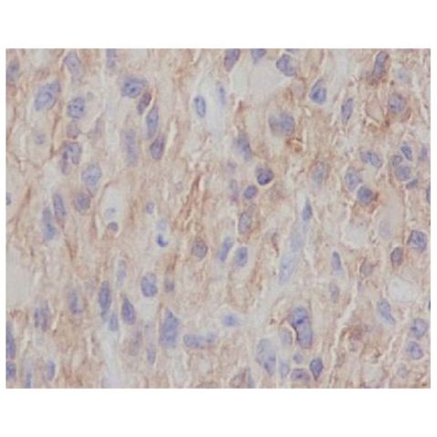 aladdin 阿拉丁 Ab119935 Recombinant NGFR Antibody Recombinant (R05-7D3); Rabbit anti Human NGFR Antibody; WB, IHC; Unconjugated