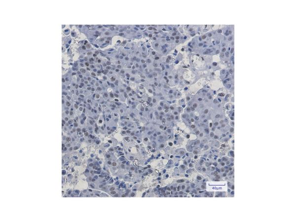 aladdin 阿拉丁 Ab119979 Recombinant PABPN1 Antibody Recombinant (R02-8B1); Rabbit anti Human PABPN1 Antibody; WB, IHC; Unconjugated