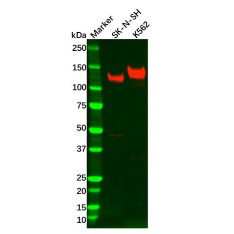 aladdin 阿拉丁 Ab120172 TrkA Antibody pAb; Rabbit anti Human TrkA Antibody; WB, IHC; Unconjugated