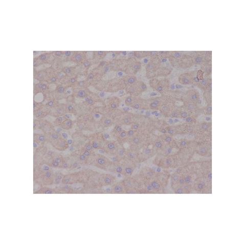 aladdin 阿拉丁 Ab120172 TrkA Antibody pAb; Rabbit anti Human TrkA Antibody; WB, IHC; Unconjugated