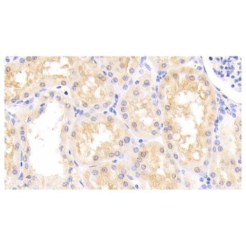 aladdin 阿拉丁 Ab120346 PARK7 Antibody pAb; Rabbit anti Human PARK7 Antibody; WB, IHC; Unconjugated