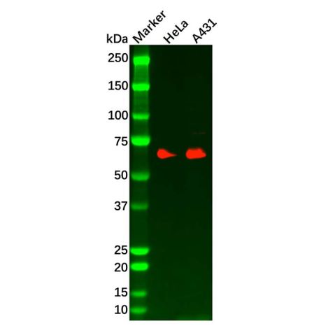 aladdin 阿拉丁 Ab120531 Recombinant Paxillin Antibody Recombinant (R04-3C3); Rabbit anti Human Paxillin Antibody; WB, IHC, ICC, IF; Unconjugated