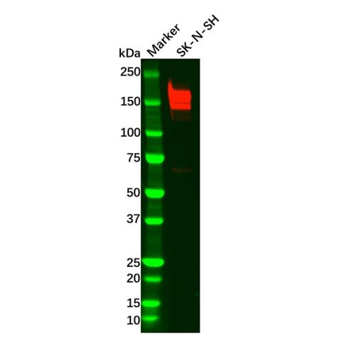 aladdin 阿拉丁 Ab120939 Recombinant PDGFR beta Antibody Recombinant (R02-5B2); Rabbit anti Human PDGFR beta Antibody; WB; Unconjugated