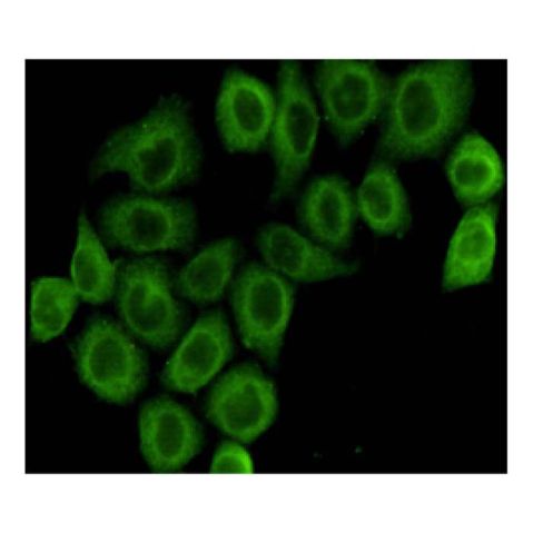 aladdin 阿拉丁 Ab120952 PDHA1 Mouse mAb mAb (3H2-F8-B5); Mouse anti Human PDHA1 Antibody; WB, ICC, IF; Unconjugated