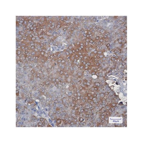 aladdin 阿拉丁 Ab121322 Recombinant Peroxiredoxin 2/PRP Antibody Recombinant (R02-1G5); Rabbit anti Human Peroxiredoxin 2/PRP Antibody; WB, IHC; Unconjugated