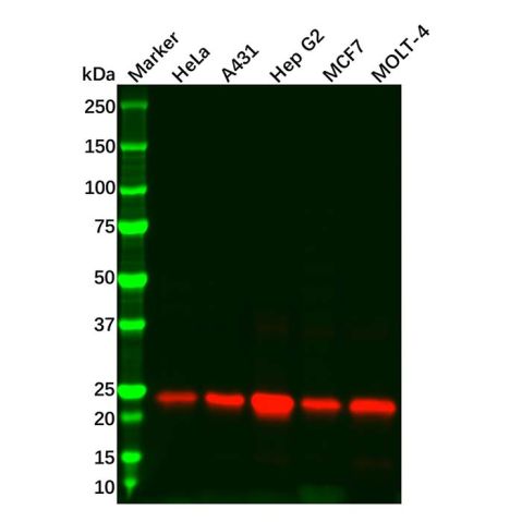 aladdin 阿拉丁 Ab121327 Recombinant Peroxiredoxin 3/PRDX3 Antibody Recombinant (R07-3I3); Rabbit anti Human Peroxiredoxin 3/PRDX3 Antibody; WB, ICC, IF, IHC; Unconjugated