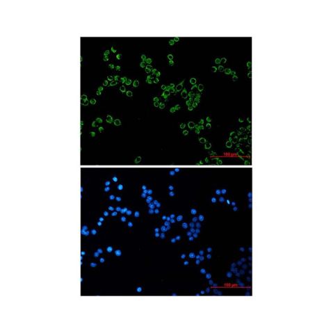 aladdin 阿拉丁 Ab121327 Recombinant Peroxiredoxin 3/PRDX3 Antibody Recombinant (R07-3I3); Rabbit anti Human Peroxiredoxin 3/PRDX3 Antibody; WB, ICC, IF, IHC; Unconjugated