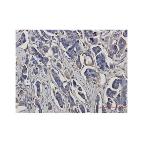 aladdin 阿拉丁 Ab121327 Recombinant Peroxiredoxin 3/PRDX3 Antibody Recombinant (R07-3I3); Rabbit anti Human Peroxiredoxin 3/PRDX3 Antibody; WB, ICC, IF, IHC; Unconjugated