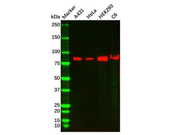 aladdin 阿拉丁 Ab121783 Recombinant PI 3 Kinase p85 beta Antibody Recombinant (R06-5H3); Rabbit anti Human PIK3R2 Antibody; WB, IHC; Unconjugated