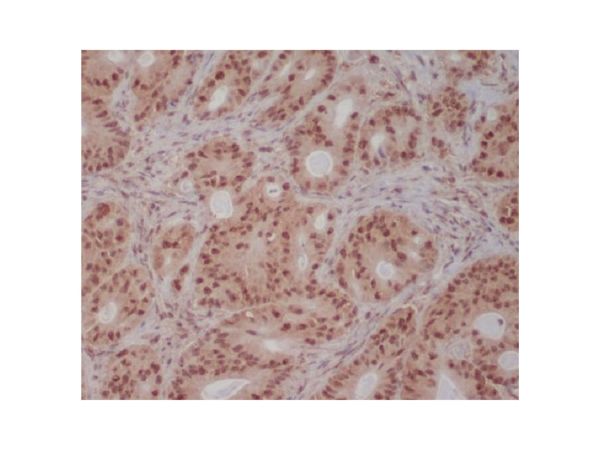 aladdin 阿拉丁 Ab121783 Recombinant PI 3 Kinase p85 beta Antibody Recombinant (R06-5H3); Rabbit anti Human PIK3R2 Antibody; WB, IHC; Unconjugated