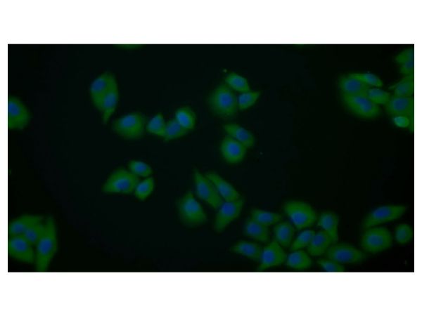 aladdin 阿拉丁 Ab122143 PKM Antibody pAb; Rabbit anti Human PKM Antibody; WB, IHC, ICC, IF; Unconjugated