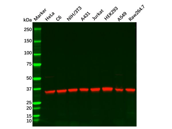aladdin 阿拉丁 Ab122709 Recombinant PP2A alpha/beta Antibody Recombinant (R04-4G4); Rabbit anti Human PP2A alpha/beta Antibody; WB, IHC, ICC, IF; Unconjugated