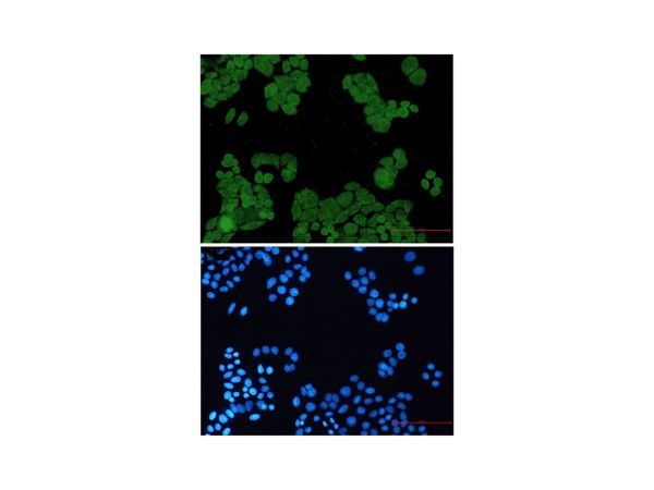 aladdin 阿拉丁 Ab122709 Recombinant PP2A alpha/beta Antibody Recombinant (R04-4G4); Rabbit anti Human PP2A alpha/beta Antibody; WB, IHC, ICC, IF; Unconjugated