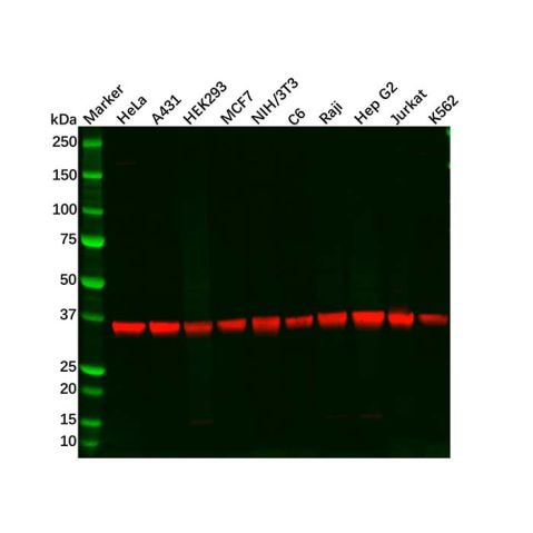 aladdin 阿拉丁 Ab122822 Recombinant PPP1CB Antibody Recombinant (R09-6B7); Rabbit anti Human PPP1CB Antibody; WB, IHC, ICC, IF; Unconjugated