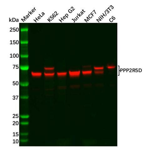 aladdin 阿拉丁 Ab122874 Recombinant PPP2R5D Antibody Recombinant (R08-2A4); Rabbit anti Human PPP2R5D Antibody; WB; Unconjugated