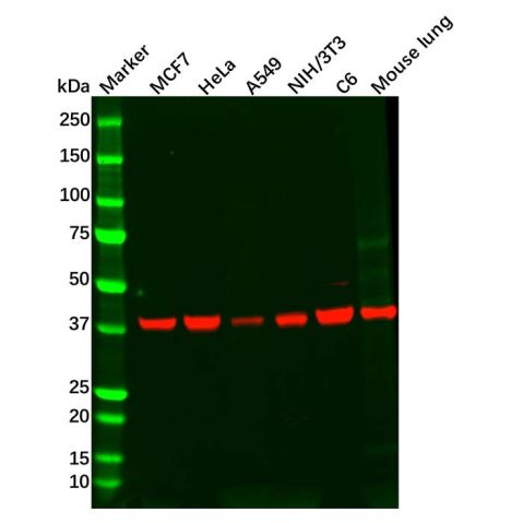 aladdin 阿拉丁 Ab123069 Recombinant PRKACG Antibody Recombinant (R01-8I1); Rabbit anti Human PRKACG Antibody; WB; Unconjugated