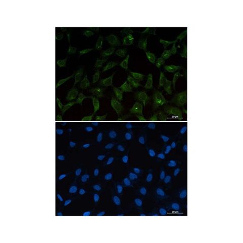 aladdin 阿拉丁 Ab123948 Recombinant PUMA Antibody Recombinant (R05-9C7); Rabbit anti Human PUMA Antibody; WB, IHC, IF, ICC; Unconjugated