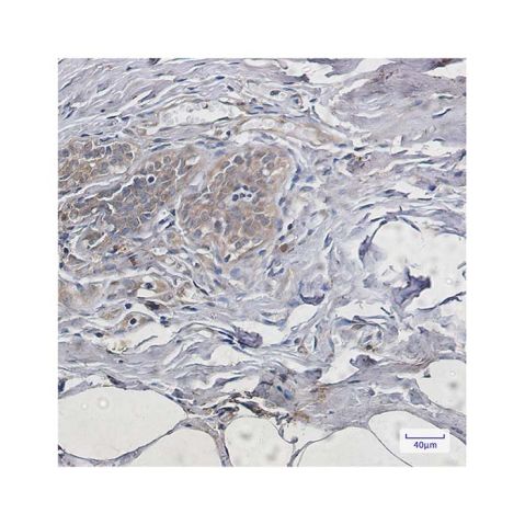 aladdin 阿拉丁 Ab123948 Recombinant PUMA Antibody Recombinant (R05-9C7); Rabbit anti Human PUMA Antibody; WB, IHC, IF, ICC; Unconjugated