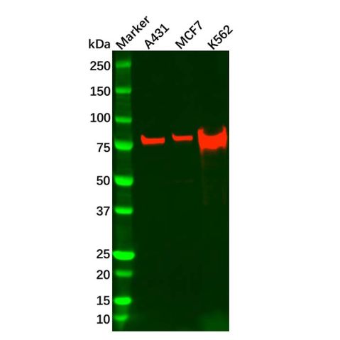 aladdin 阿拉丁 Ab126061 Recombinant RSK1 p90 Antibody Recombinant (R02-2D2); Rabbit anti Human RSK1 p90 Antibody; WB, IHC; Unconjugated
