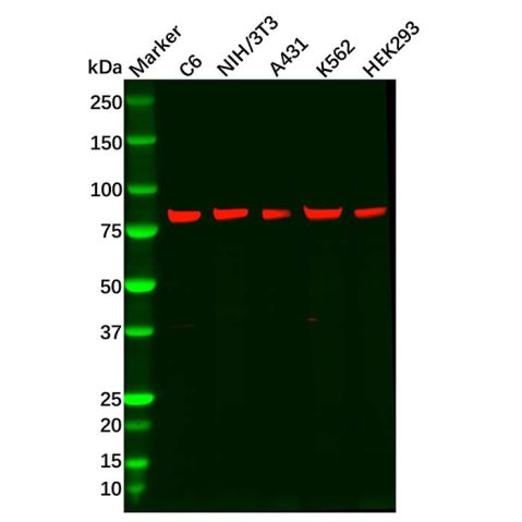 aladdin 阿拉丁 Ab126068 Recombinant RSK3 Antibody Recombinant (R05-5E4); Rabbit anti Human RSK3 Antibody; WB, IHC, ICC, IF; Unconjugated