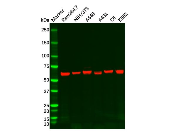 aladdin 阿拉丁 Ab126314 Recombinant S6K1 Antibody Recombinant (R01-4B5); Rabbit anti Human S6K1 Antibody; WB, ICC, IF; Unconjugated